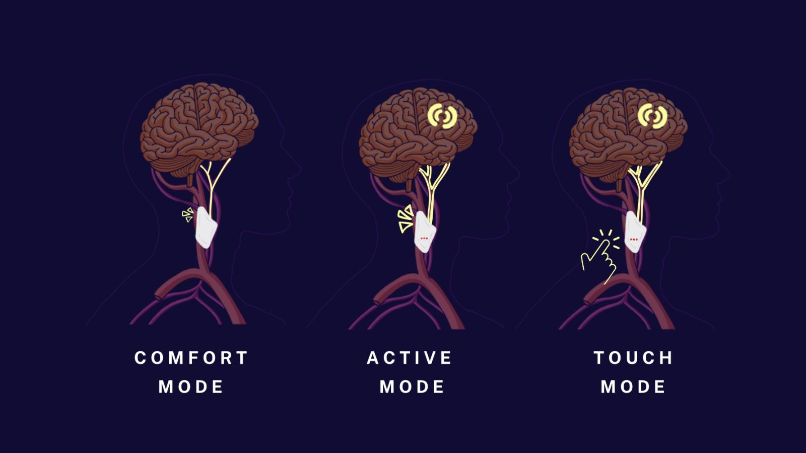 Digital illustration of the implant’s three different modes of use