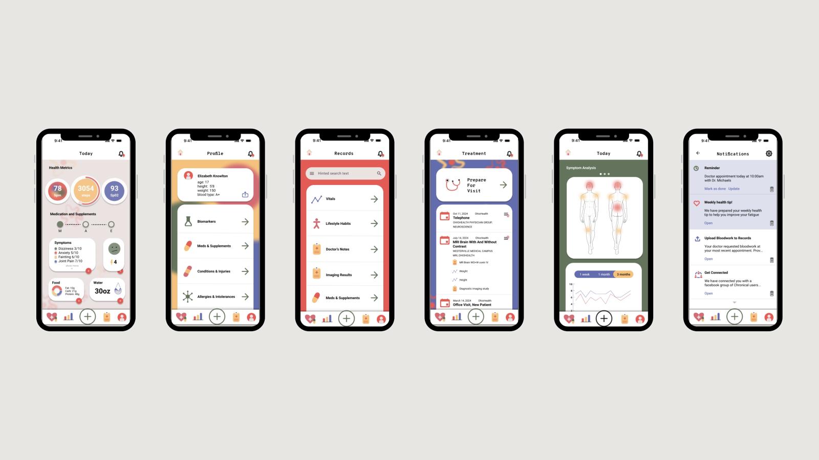 This image shows six phone screens lined up horizontally on a beige background. The first phone shows Chronical’s home screen, the second phone shows Chronical’s profile page, the third phone shows Chronical’s medica records page, the fourth phone shows Chronical’s treatment plan page, the fifth screen shows Chronical’s symptom analysis page and the sixth screen shows Chronical’s notification page.